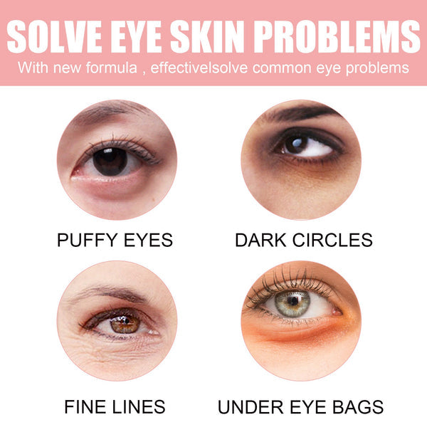 Fading Wrinkle Eye Bag